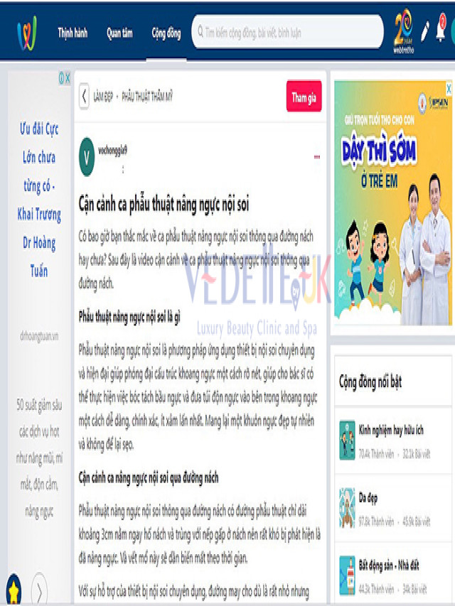 Review nâng ngực nội soi Webtretho “làm đẹp thông minh”