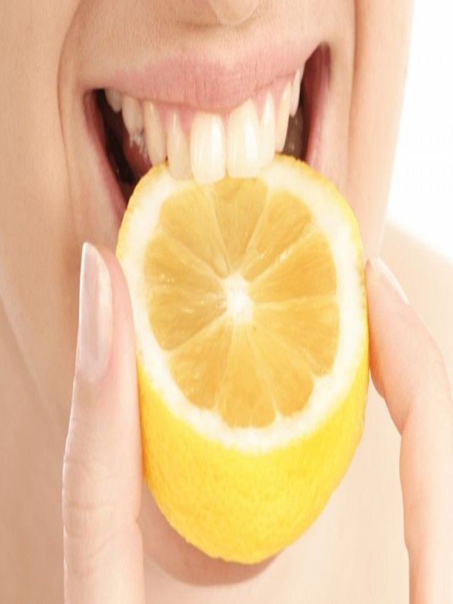 Top 5 cách làm trắng răng tốt nhất